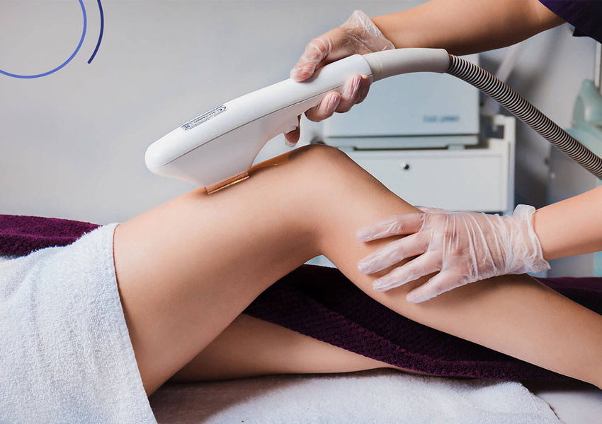 Lazer Epilasyon